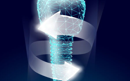 Revolutionizing Oral Health – The Power of Dental Implants