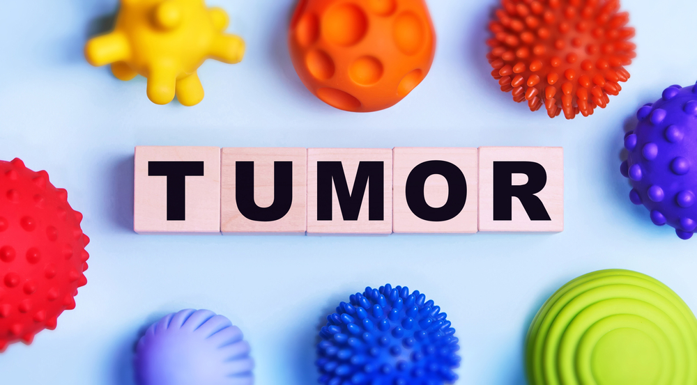 FutureBridge Releases Tumor Report on the Future of NSCLC Treatment and Evolving Trends